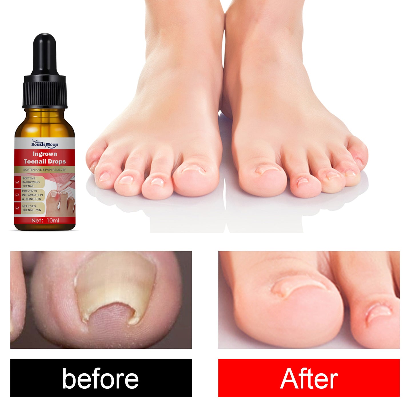 JC-250102NLC-024  South Moon Endogenous Nail Repair Nail Repair Cleaning Nail Removal Nail Care Essential Oil