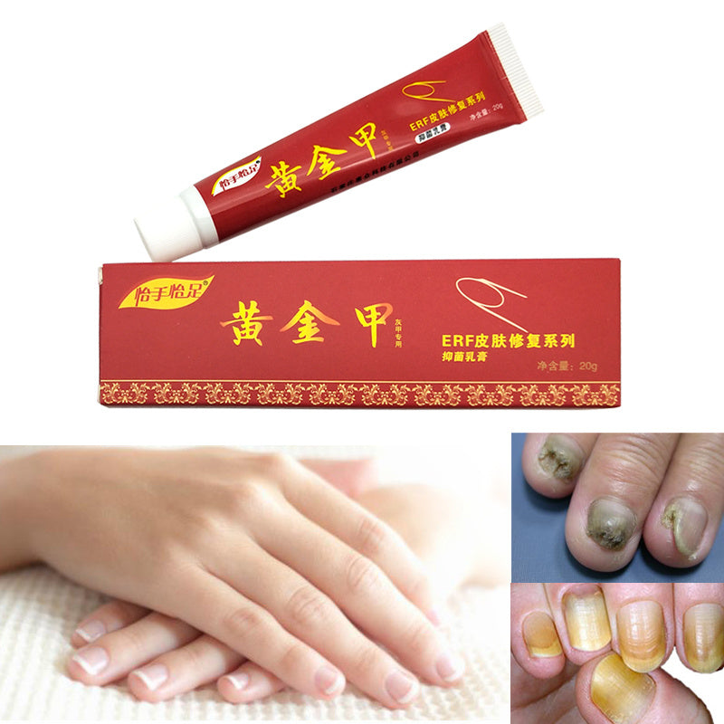 JC-250102NLC-079  Yishou Yizu Golden Nail Care Cream 20g