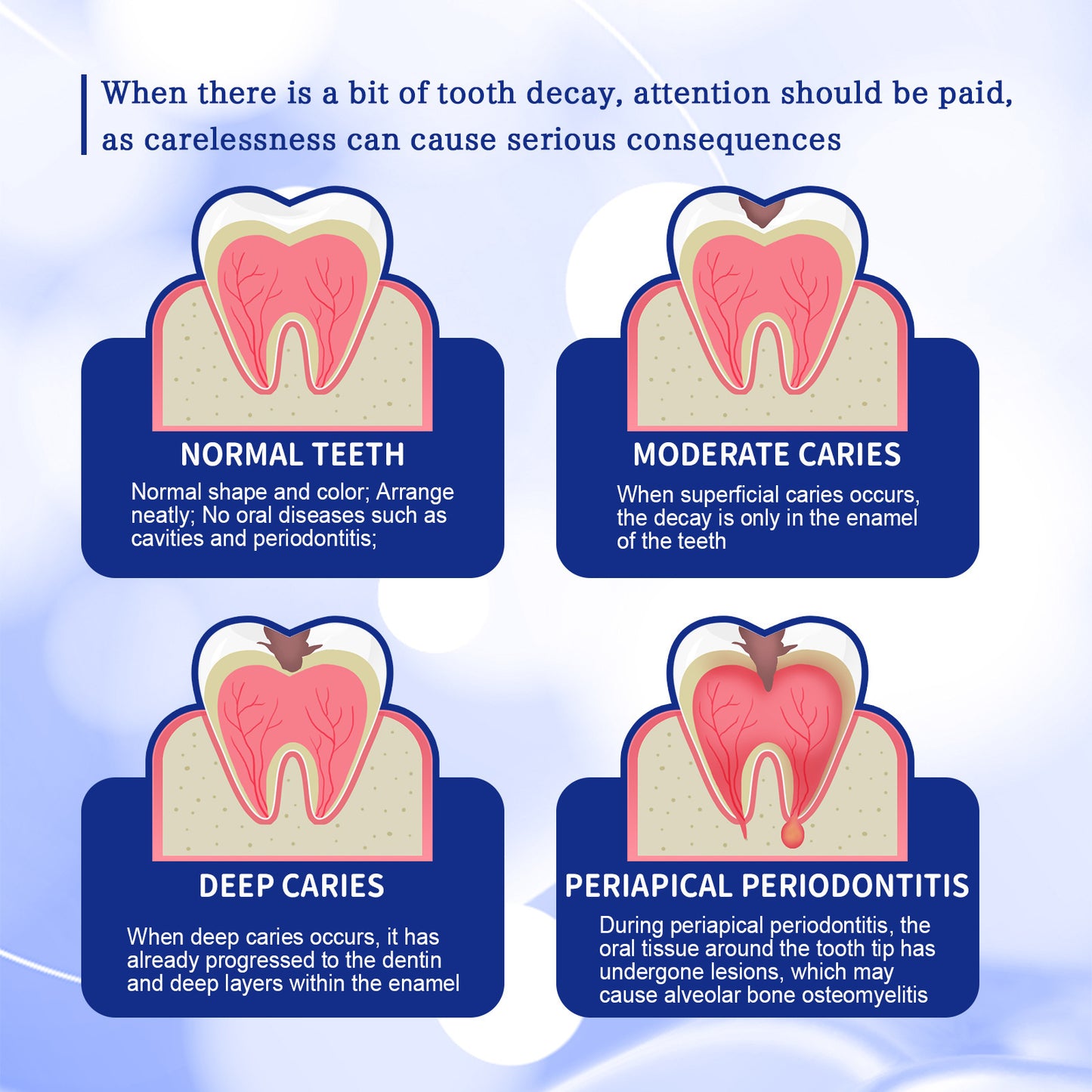 JC-250106ORL-039  Anticavity Toothpaste Oral Cleaning Yellow Tooth Decay Tooth Care Gum Fixation Tooth Care Breath