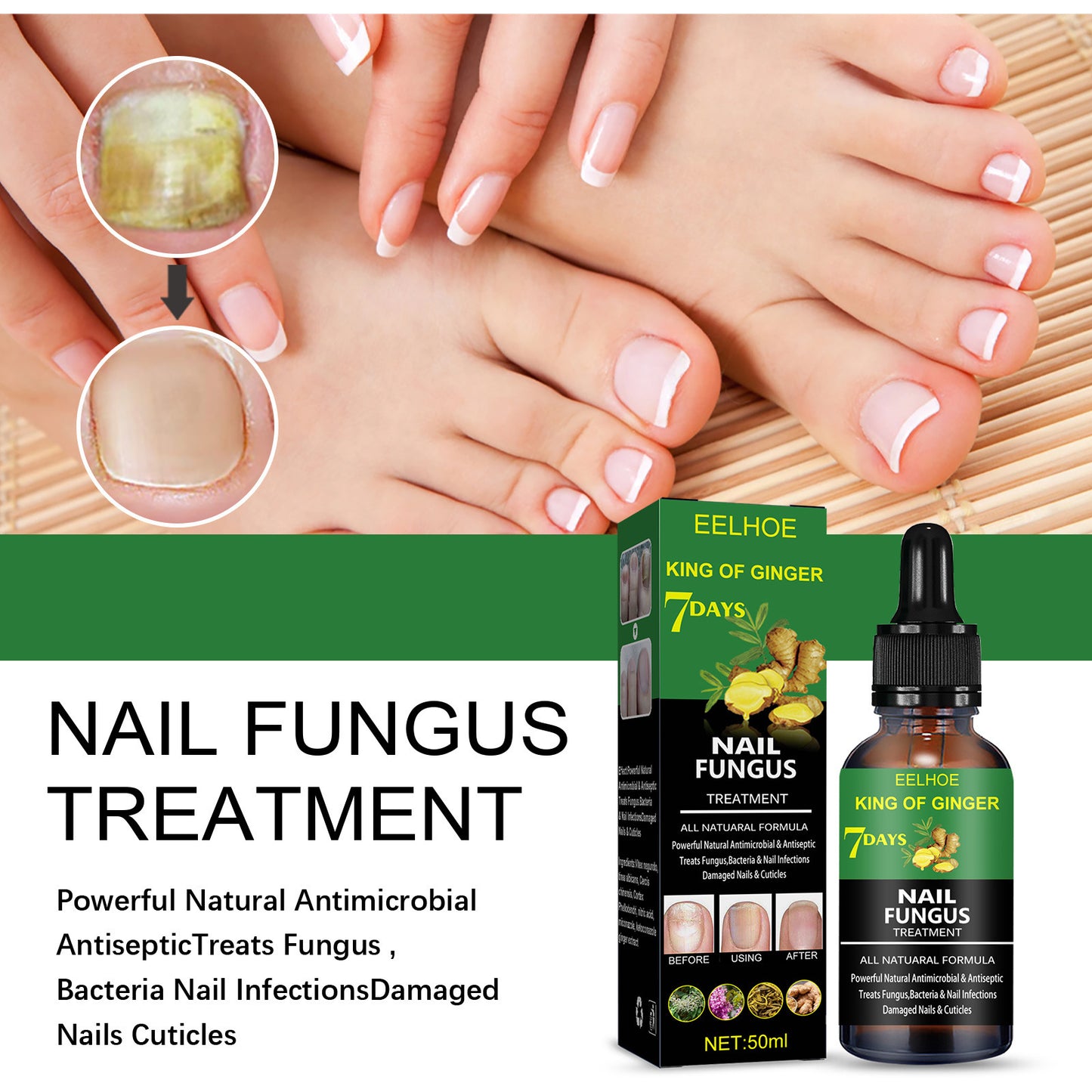 JC-250102NLC-023  Nail Repair Solution Hand Foot And Nail Care Solution