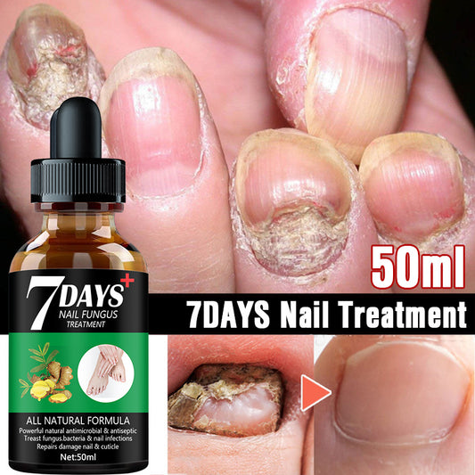 JC-250102NLC-081  7DAYS Nail Fungus Treatment Serum Care Hand And Foot Care Removal