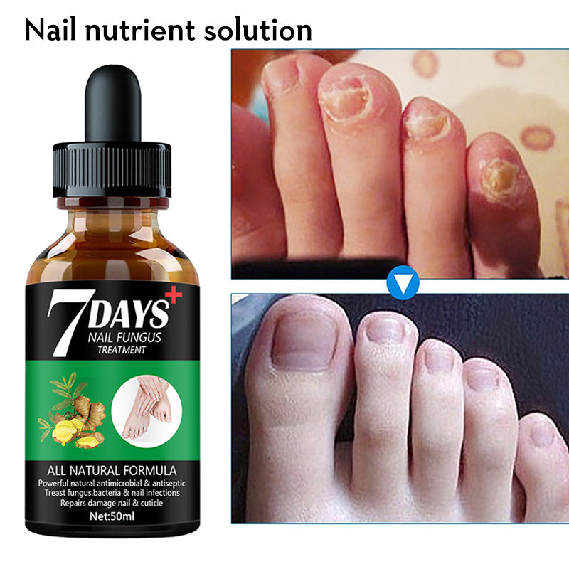 JC-250102NLC-081  7DAYS Nail Fungus Treatment Serum Care Hand And Foot Care Removal