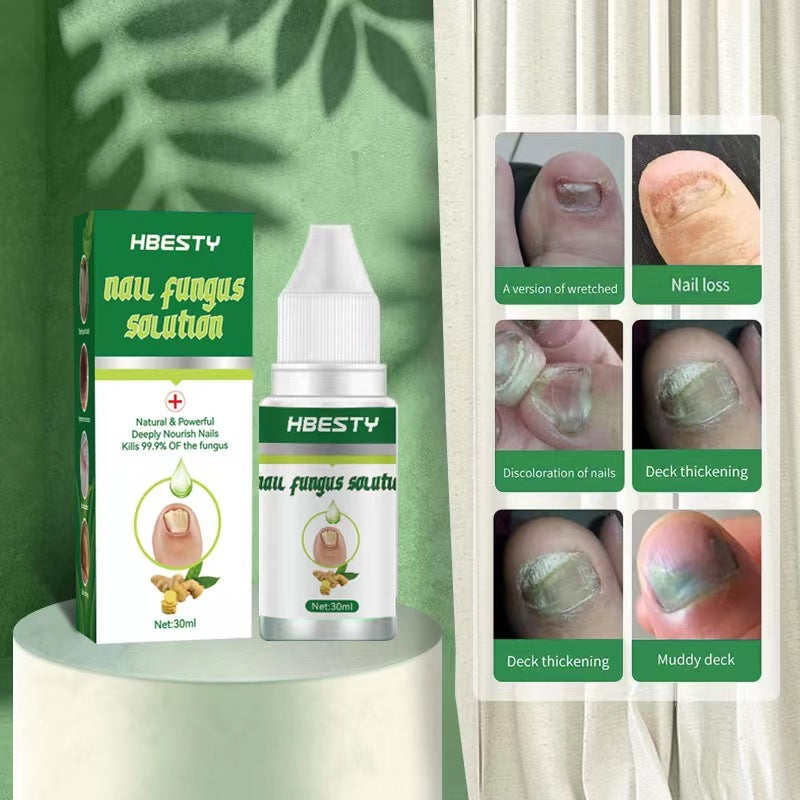 JC-250102NLC-069  Nail Fungal Treatment Feet Care Nail Foot Toe Nail Fungus Removal Gel Anti Infection Paronychia Onychomycosis