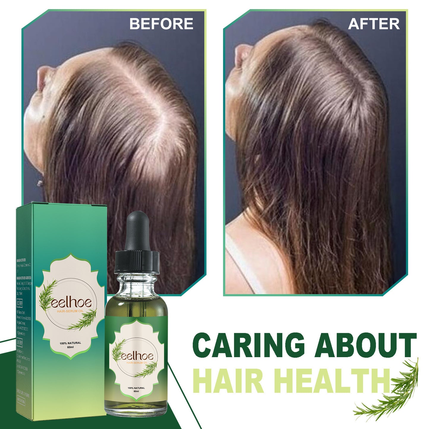 JC-250104HRC-029  Nourishing Anti-hair Loss Thick Hair Care