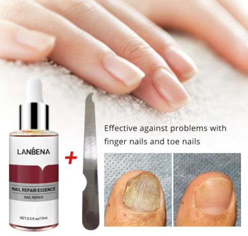 JC-250102NLC-009  Nail Repair And Care