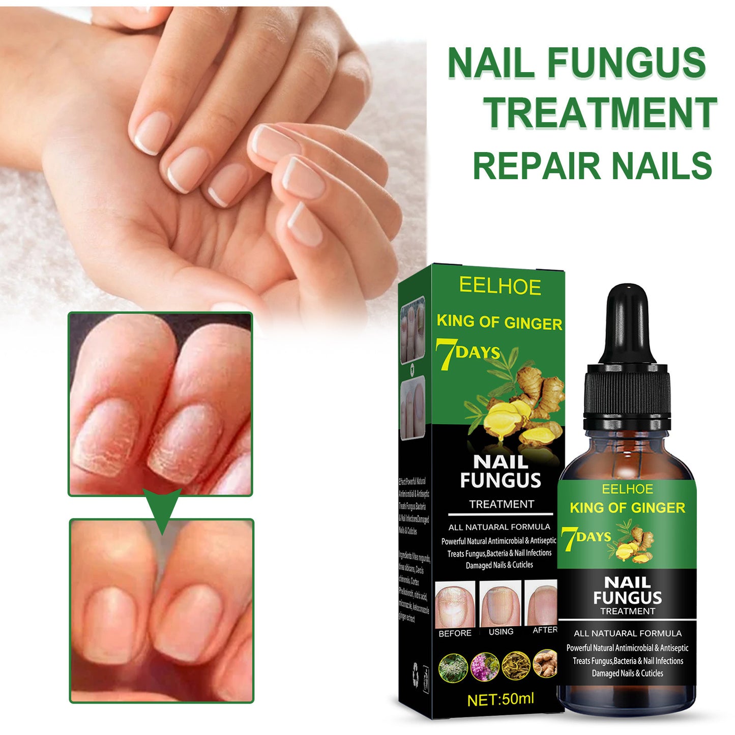 JC-250102NLC-023  Nail Repair Solution Hand Foot And Nail Care Solution