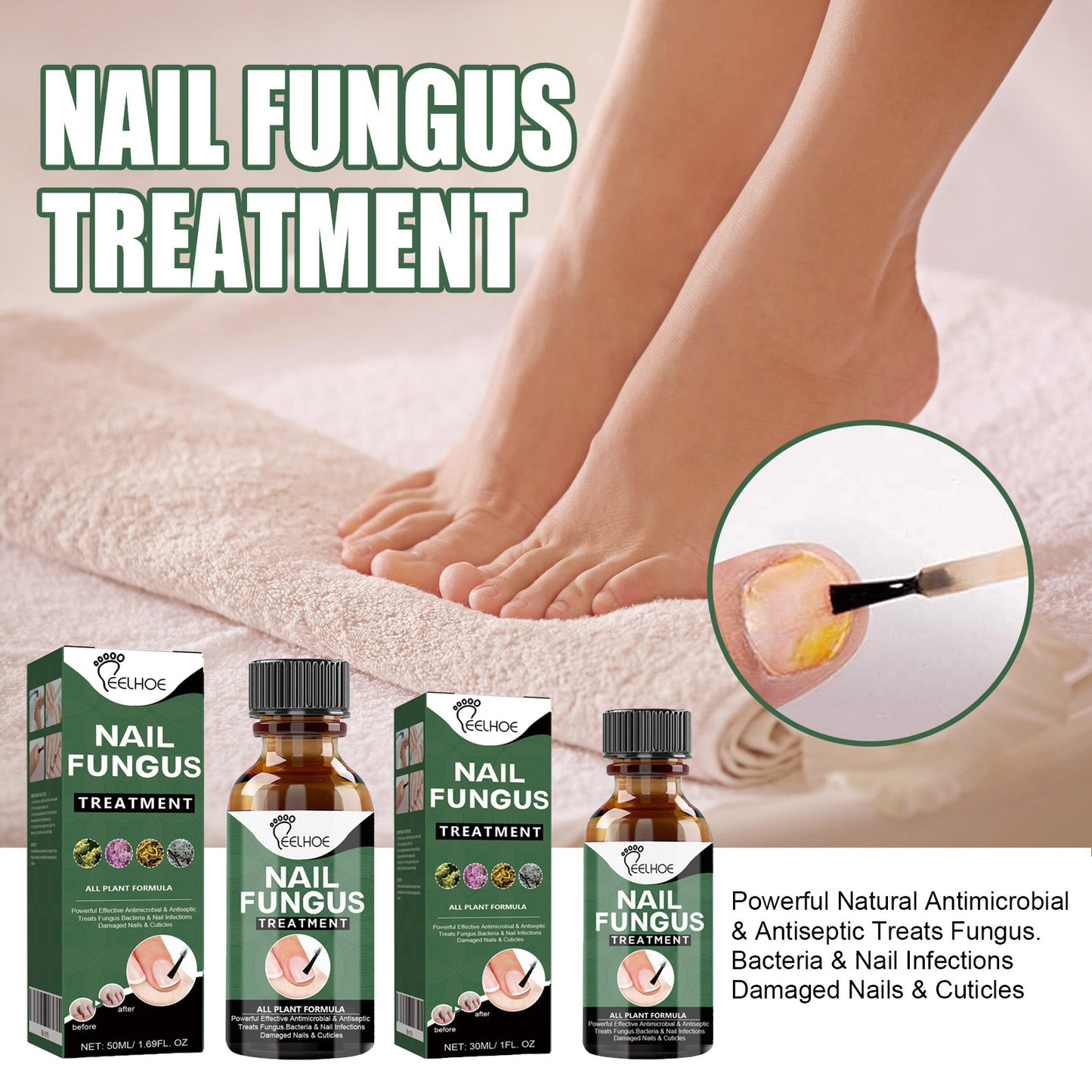 JC-250102NLC-036  Foot Care Solution Onychomycosis Nail Care Solution