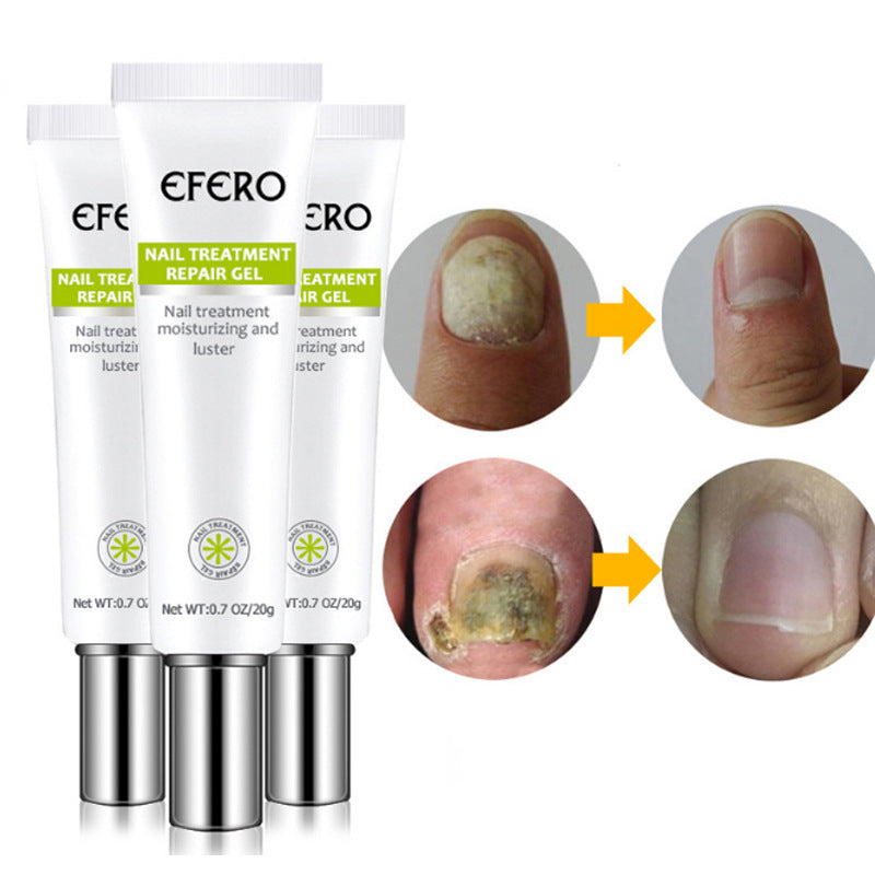 JC-250102NLC-011  Nail Treatment Serum Nail Foot Nail Fungus Removal Gel Anti Infection Onychomycosis Nail Repair Cream Feet Care