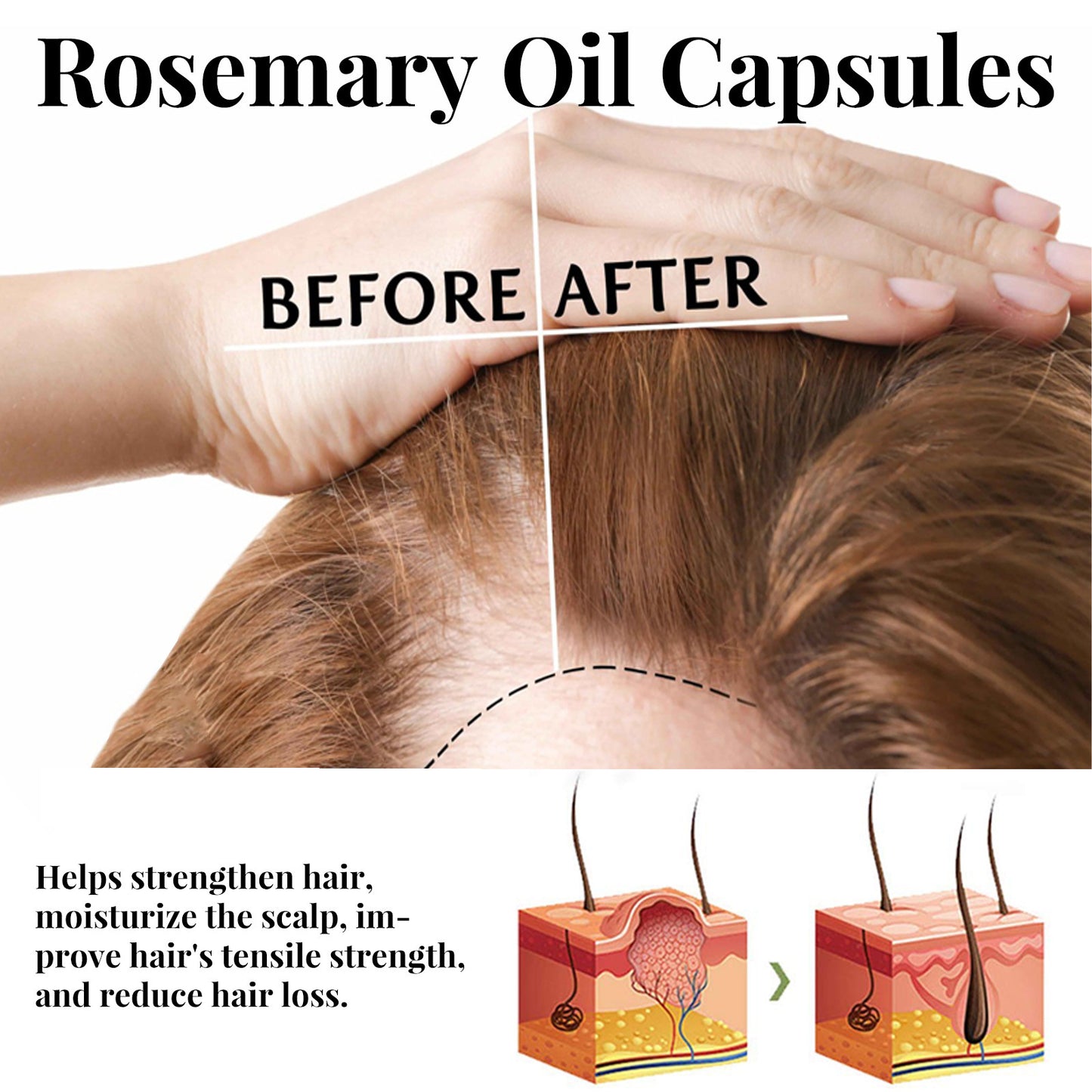 JC-250104HRC-052  Rosemary Hair Care Capsules Nourish Hair Roots And Prevent Hair Loss