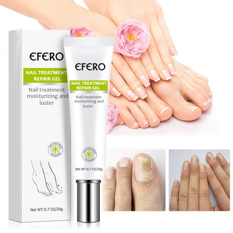 JC-250102NLC-011  Nail Treatment Serum Nail Foot Nail Fungus Removal Gel Anti Infection Onychomycosis Nail Repair Cream Feet Care