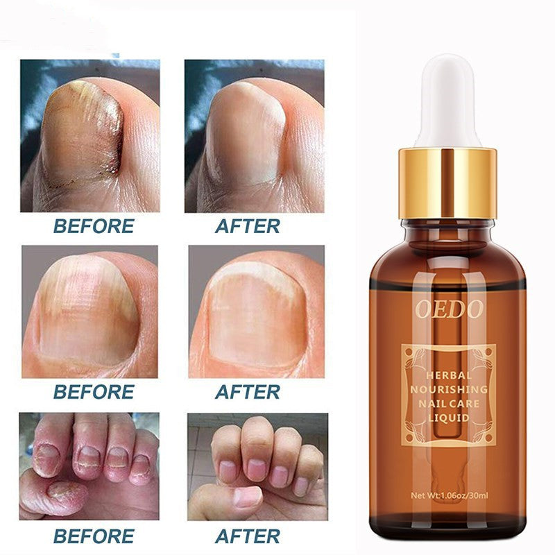 JC-250102NLC-083  Healthy Nail Care Fungus Repair Essential Oil