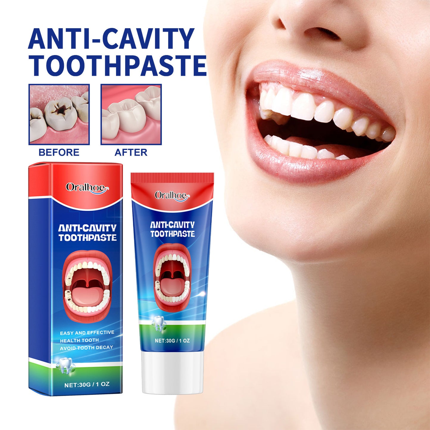 JC-250106ORL-039  Anticavity Toothpaste Oral Cleaning Yellow Tooth Decay Tooth Care Gum Fixation Tooth Care Breath