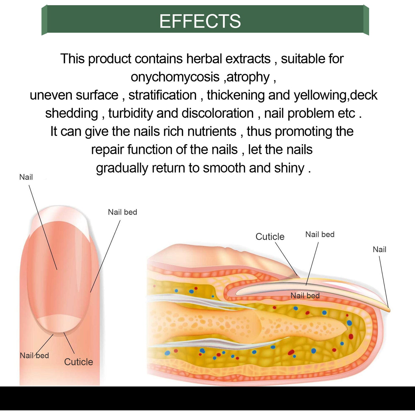 JC-250102NLC-036  Foot Care Solution Onychomycosis Nail Care Solution