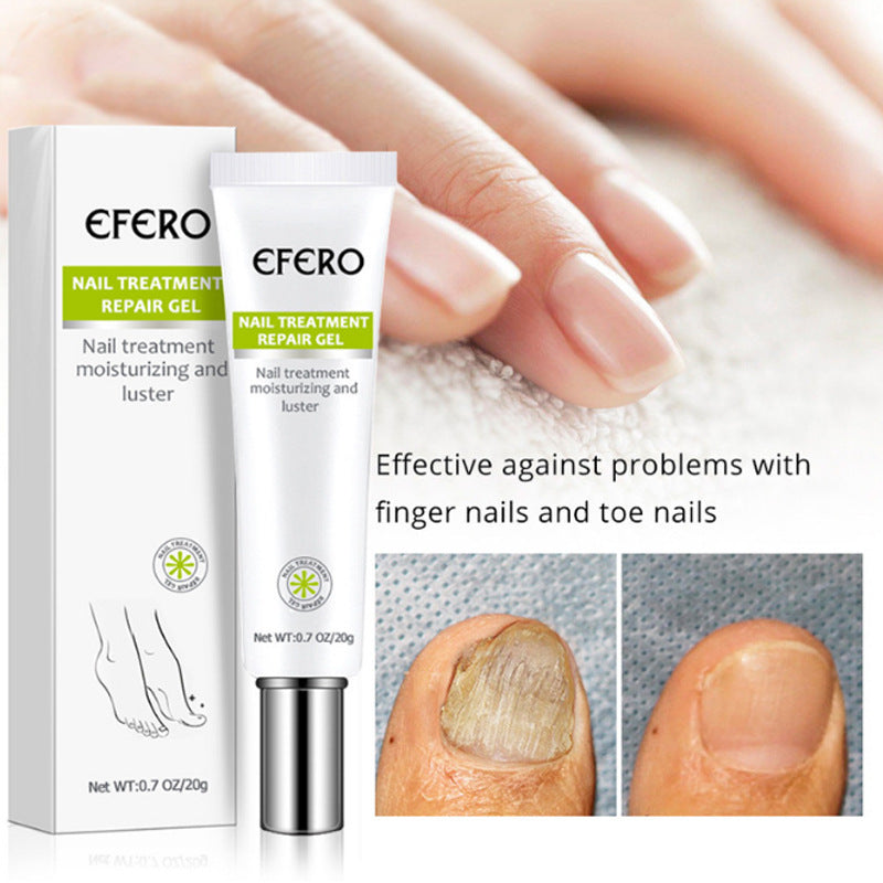 JC-250102NLC-011  Nail Treatment Serum Nail Foot Nail Fungus Removal Gel Anti Infection Onychomycosis Nail Repair Cream Feet Care