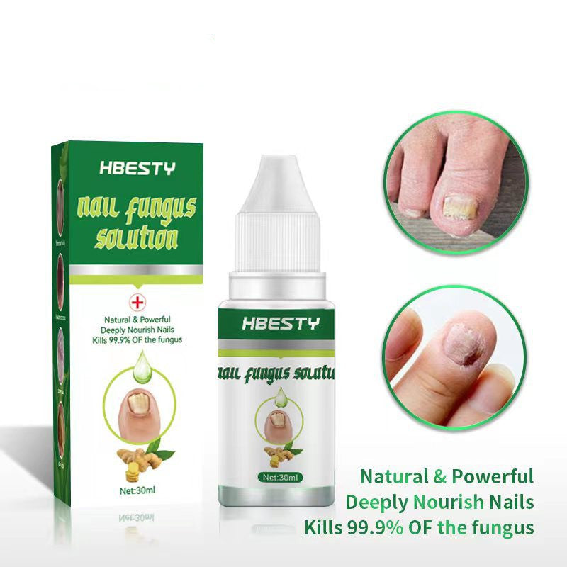 JC-250102NLC-069  Nail Fungal Treatment Feet Care Nail Foot Toe Nail Fungus Removal Gel Anti Infection Paronychia Onychomycosis