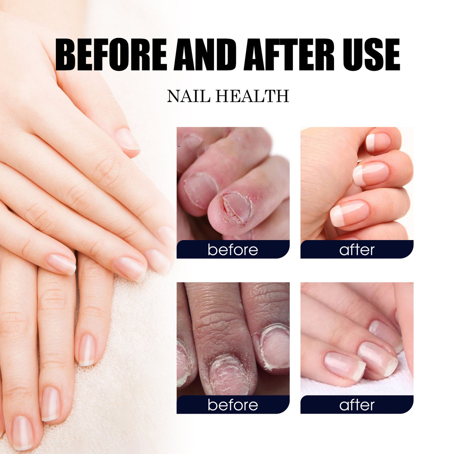 JC-250102NLC-015  Nail Care Solution Repair Hand And Foot Soft Nail Thickening Bright Nail